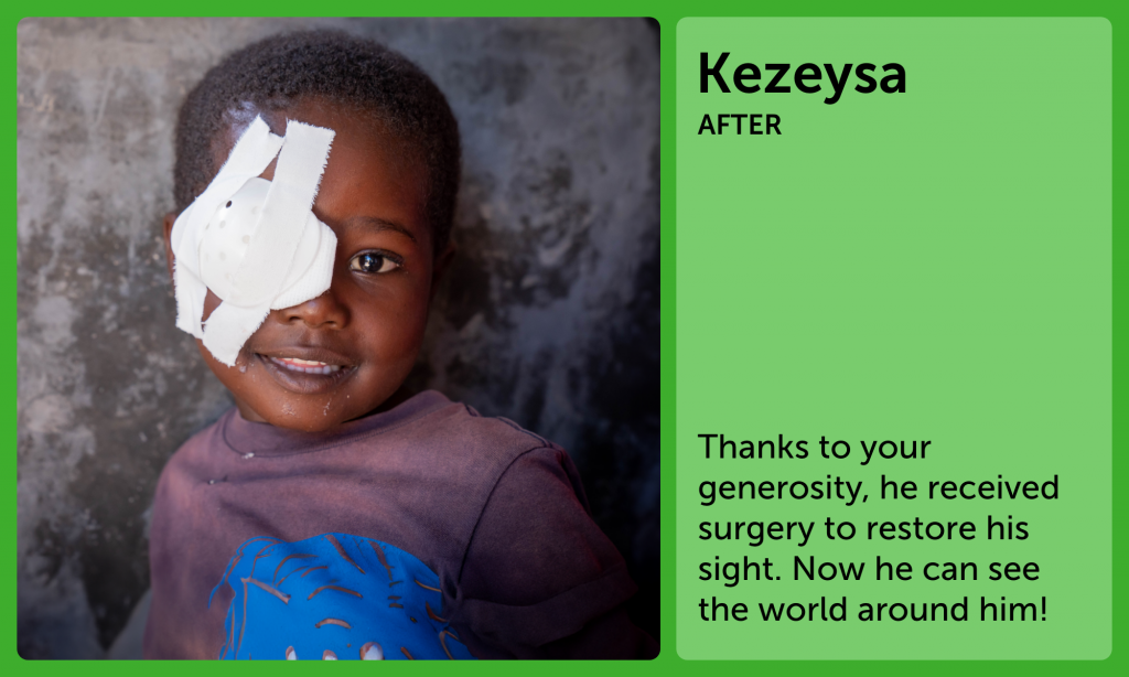 Kezeysa After