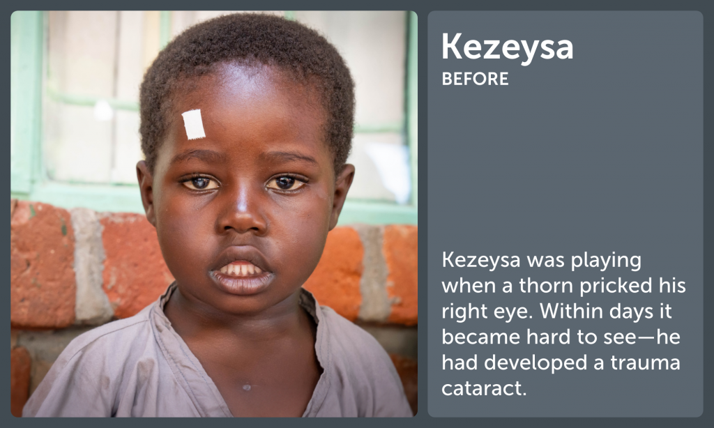 Kezeysa Before