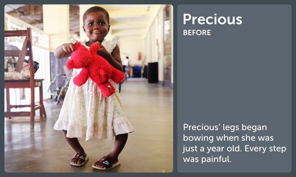 Precious Before