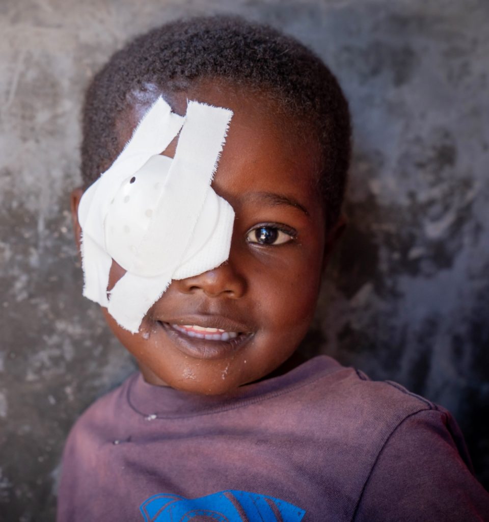 Child with an eyepatch from surgery