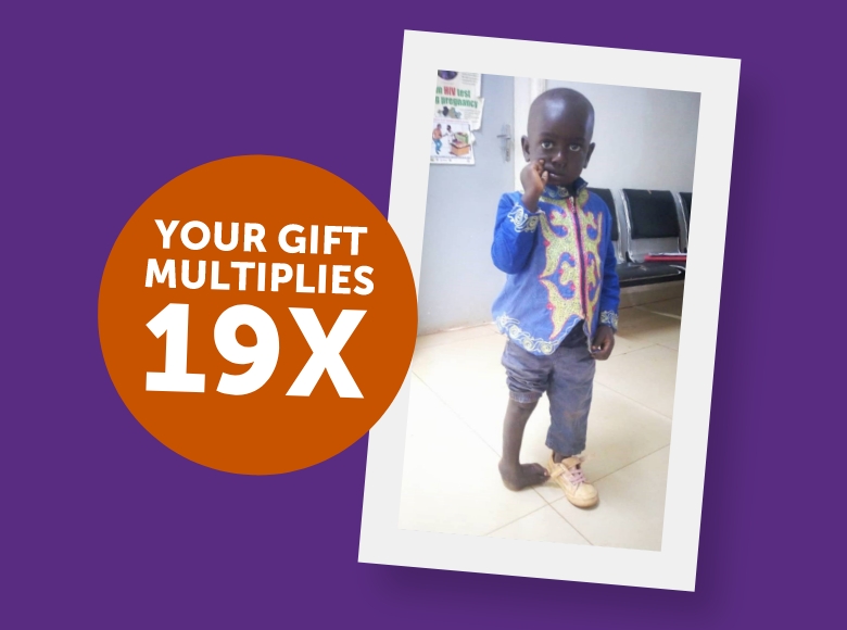 On a purple background, a polaroid image of a boy with right clubfoot stands in a hospital hallway. An orange circle on the left side of the photo reads "YOUR GIFT MULTIPLIES 19X"